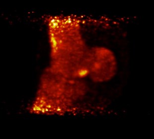 3D PET data of the fetlock of a 2-year-old research Thoroughbred recently retired from race training. This data was acquired with a 4-minute scan time
